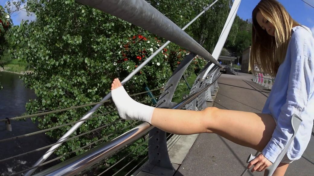 Melinda 183 Sprain - I rest my sprained foot on the bridge - 11 min