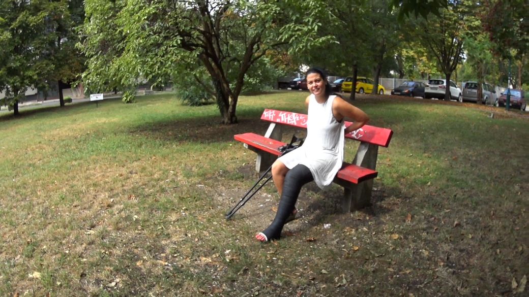 Timmi 1808-7 LLC - I like to show my long leg cast for people - 10 min