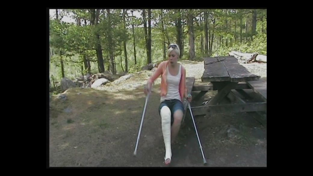 Tiiger 11 LLC - I can’t walk on this bent long leg cast - 5 min