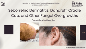 Seb Derm, Dandruff, Cradle Cap, and Fungal Overgrowth Presentation